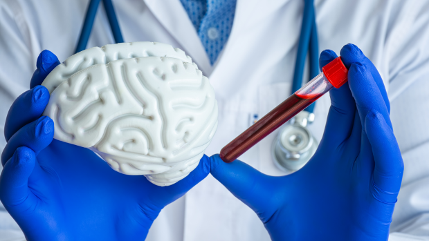 Person in doctors coat holds a model brain next to a red vial.