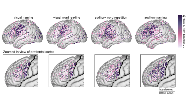 Brain scans with areas marked where increased activity is taking place. 